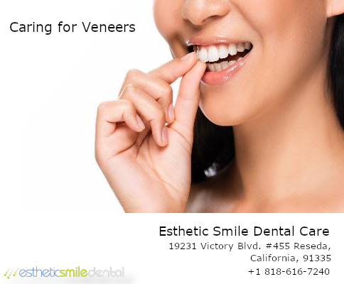 Dental Veneers Aftercare